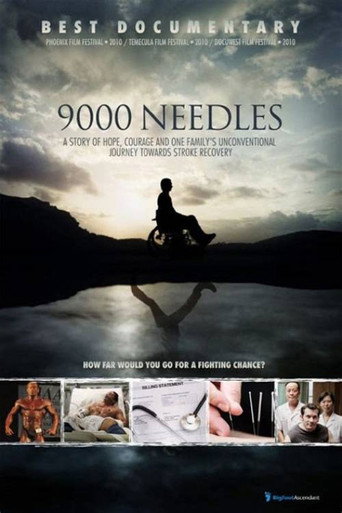 9000 إبرة