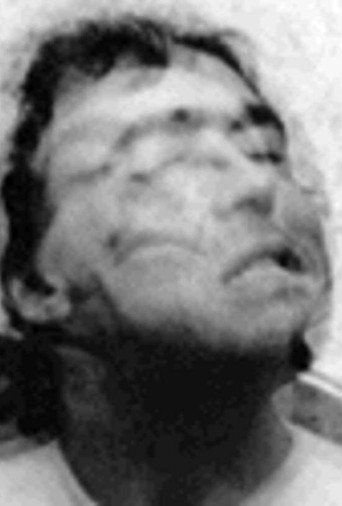 نشل والصراخ