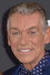 Patrick Dupond
